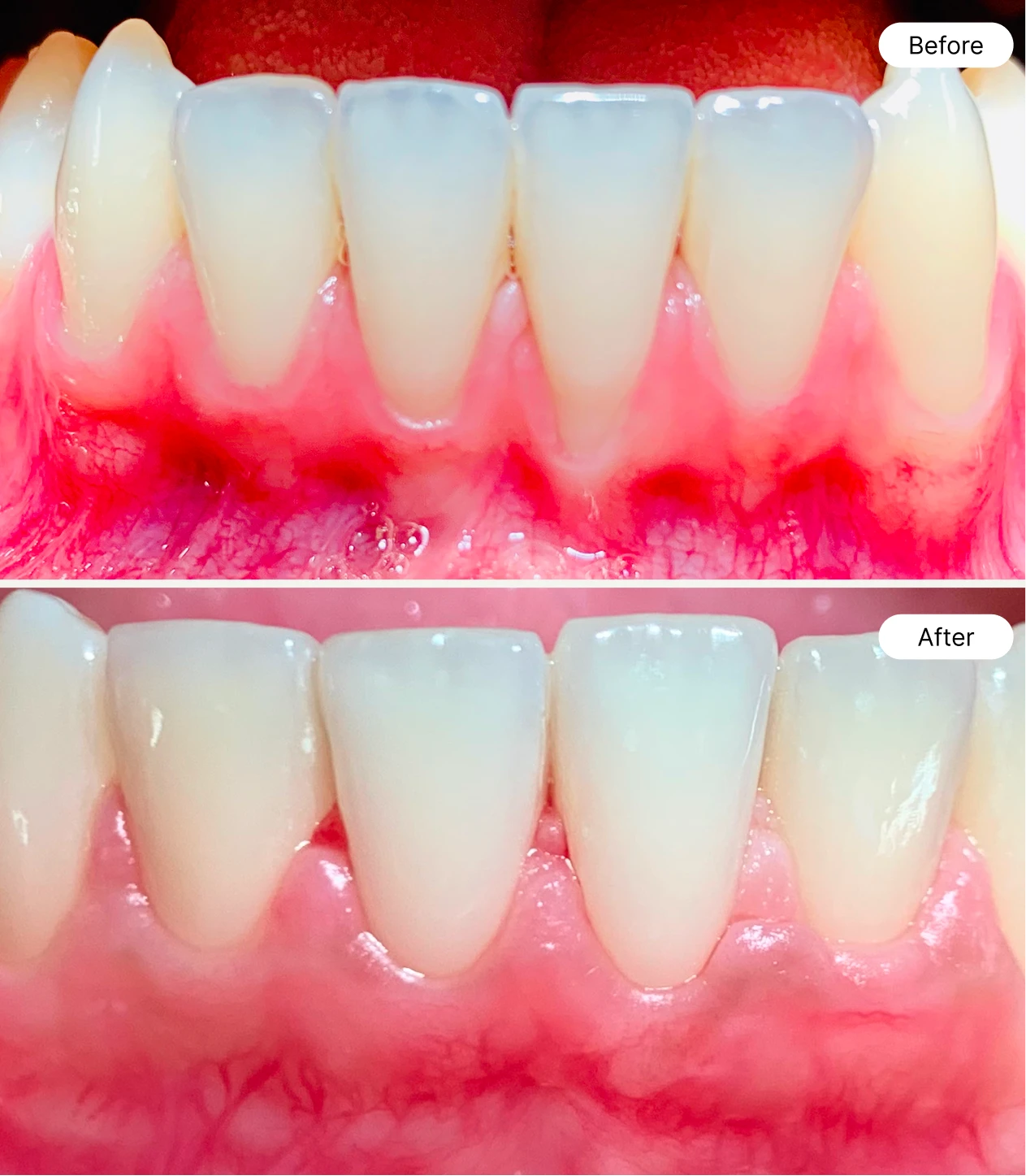 life oral health before and after case 2