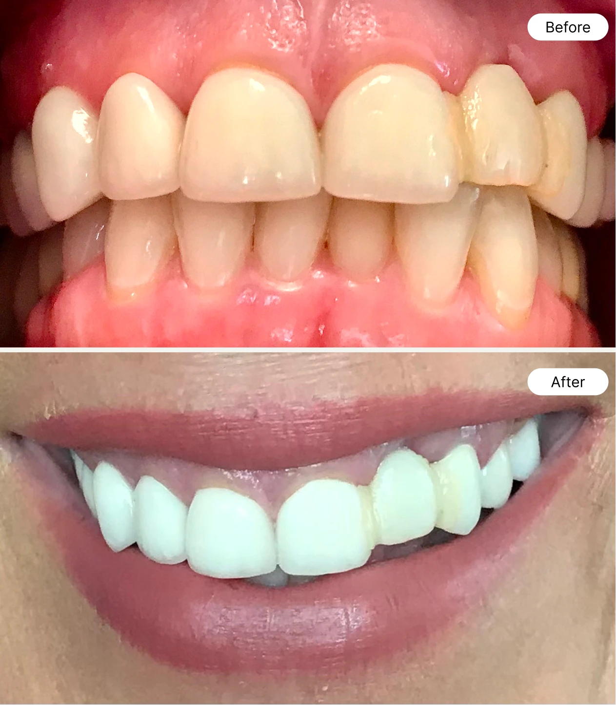 life oral health before and after case 3