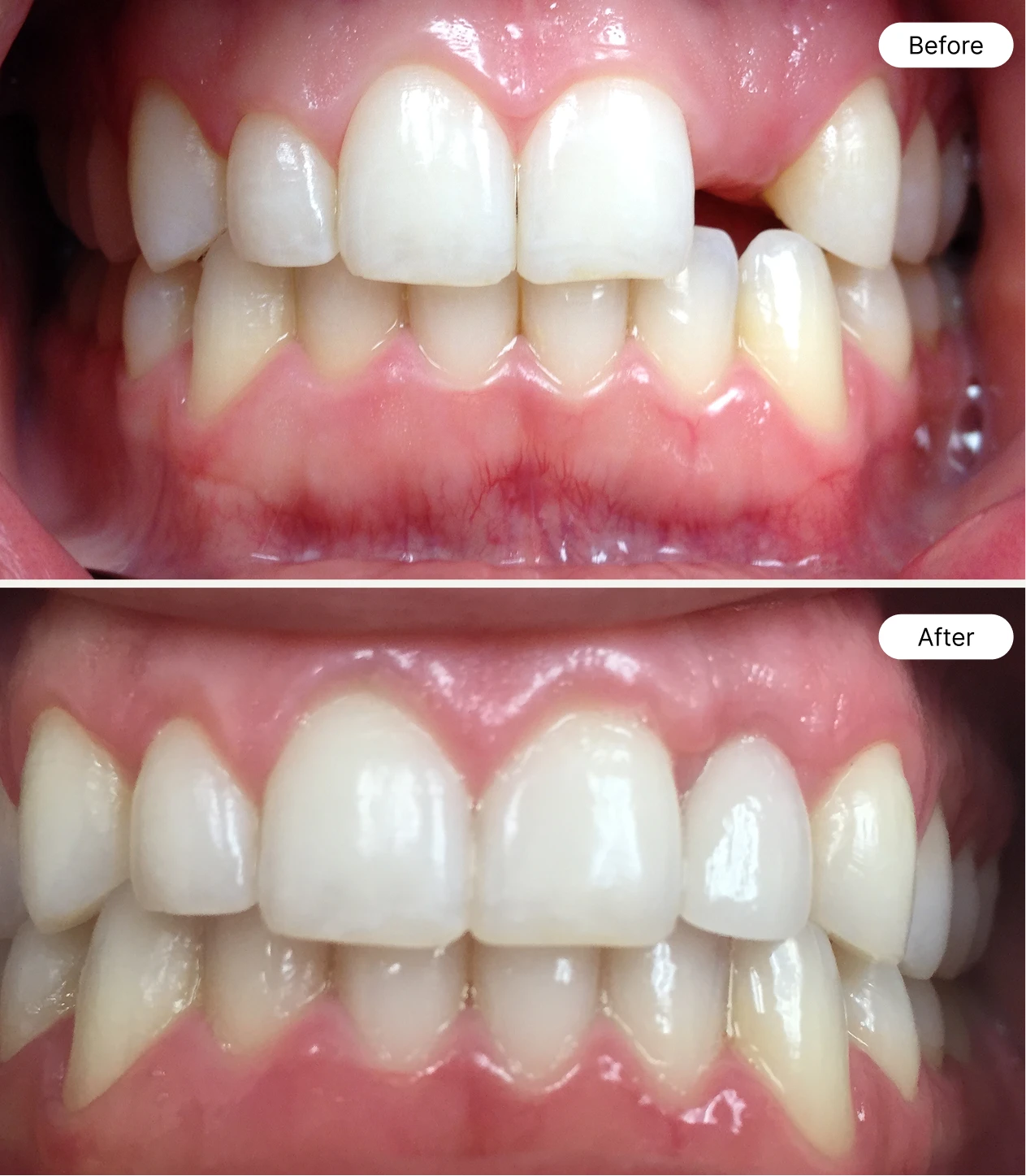 life oral health before and after case 4