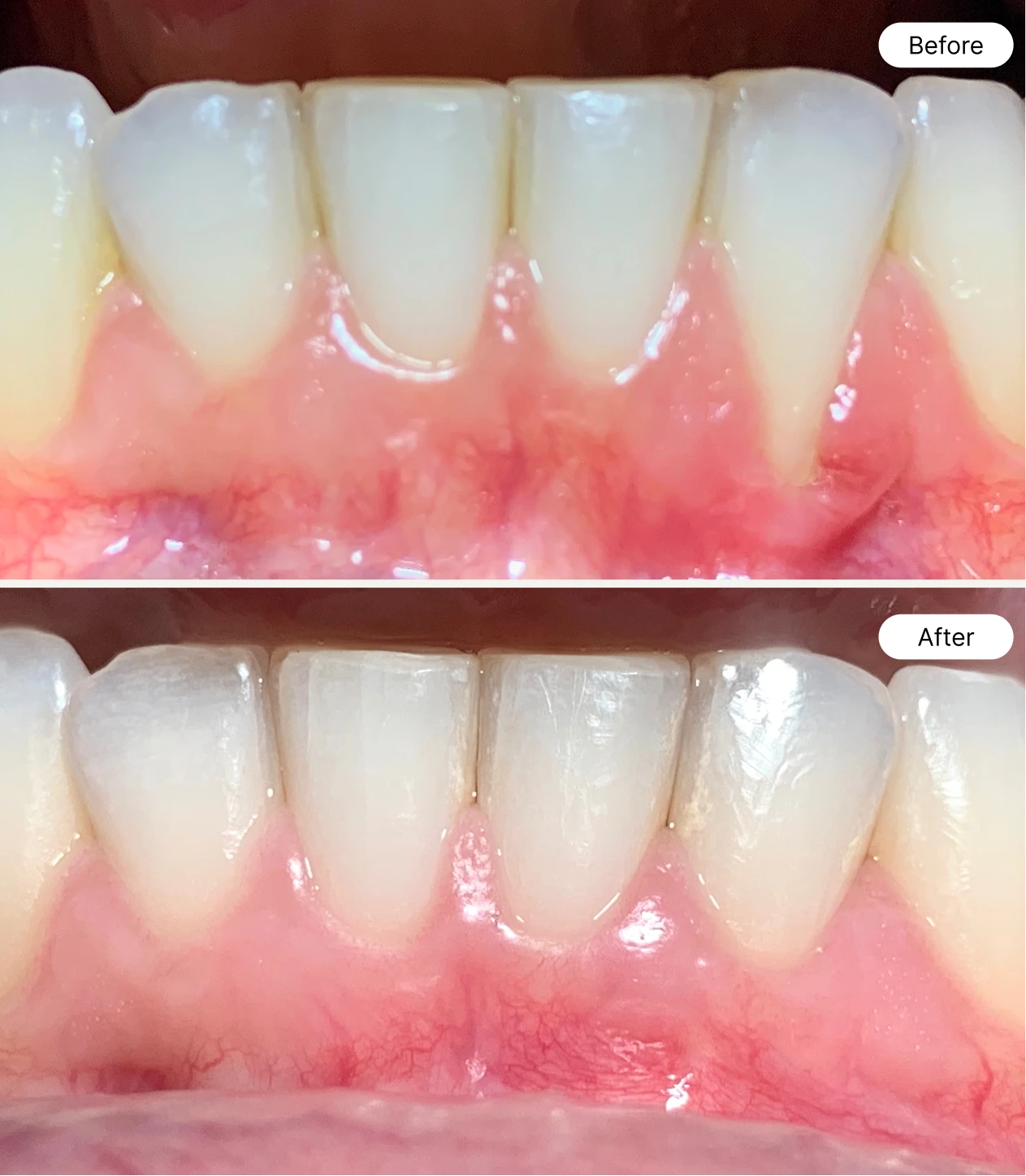 life oral health before and after case 5