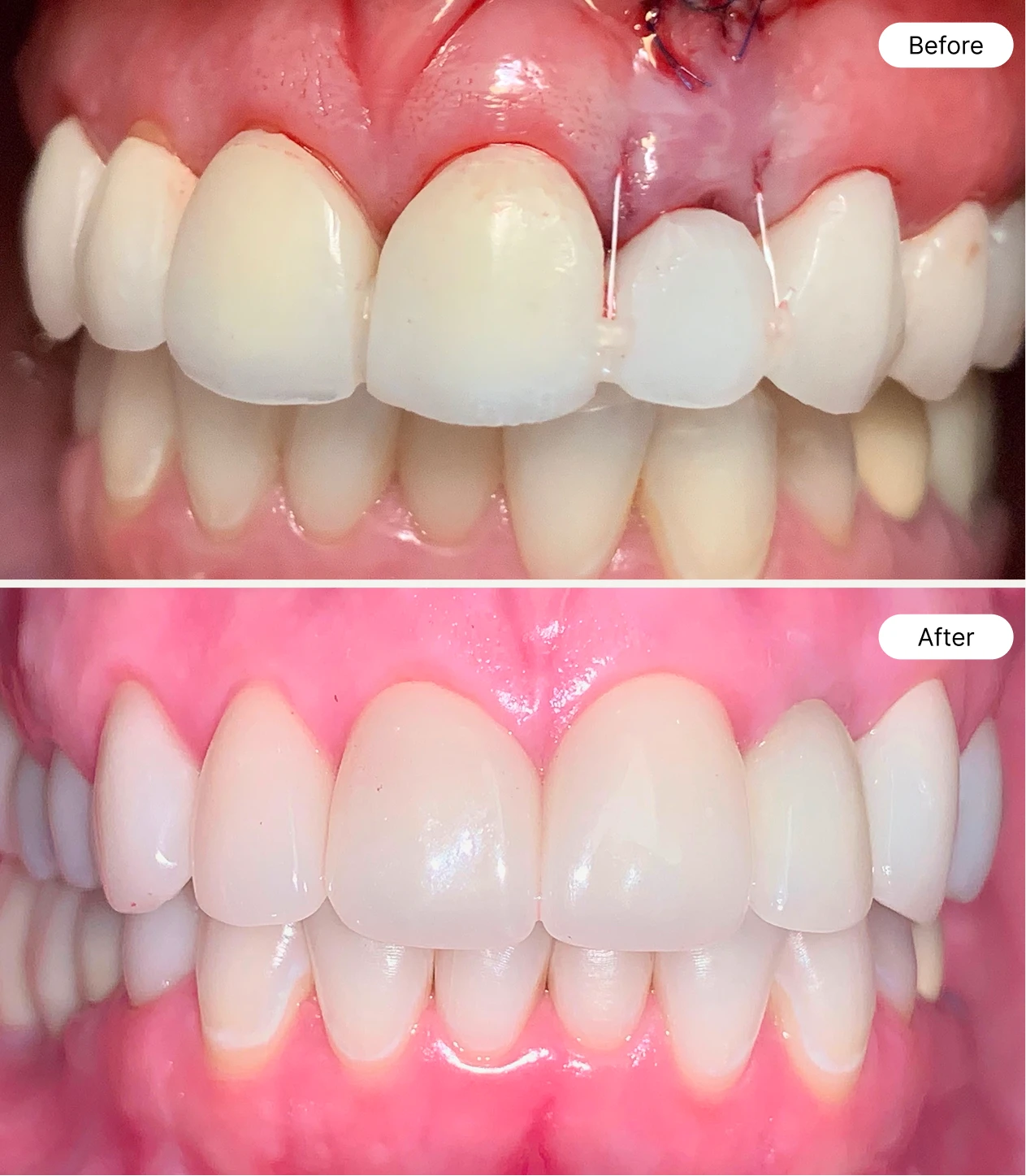 life oral health before and after case 6