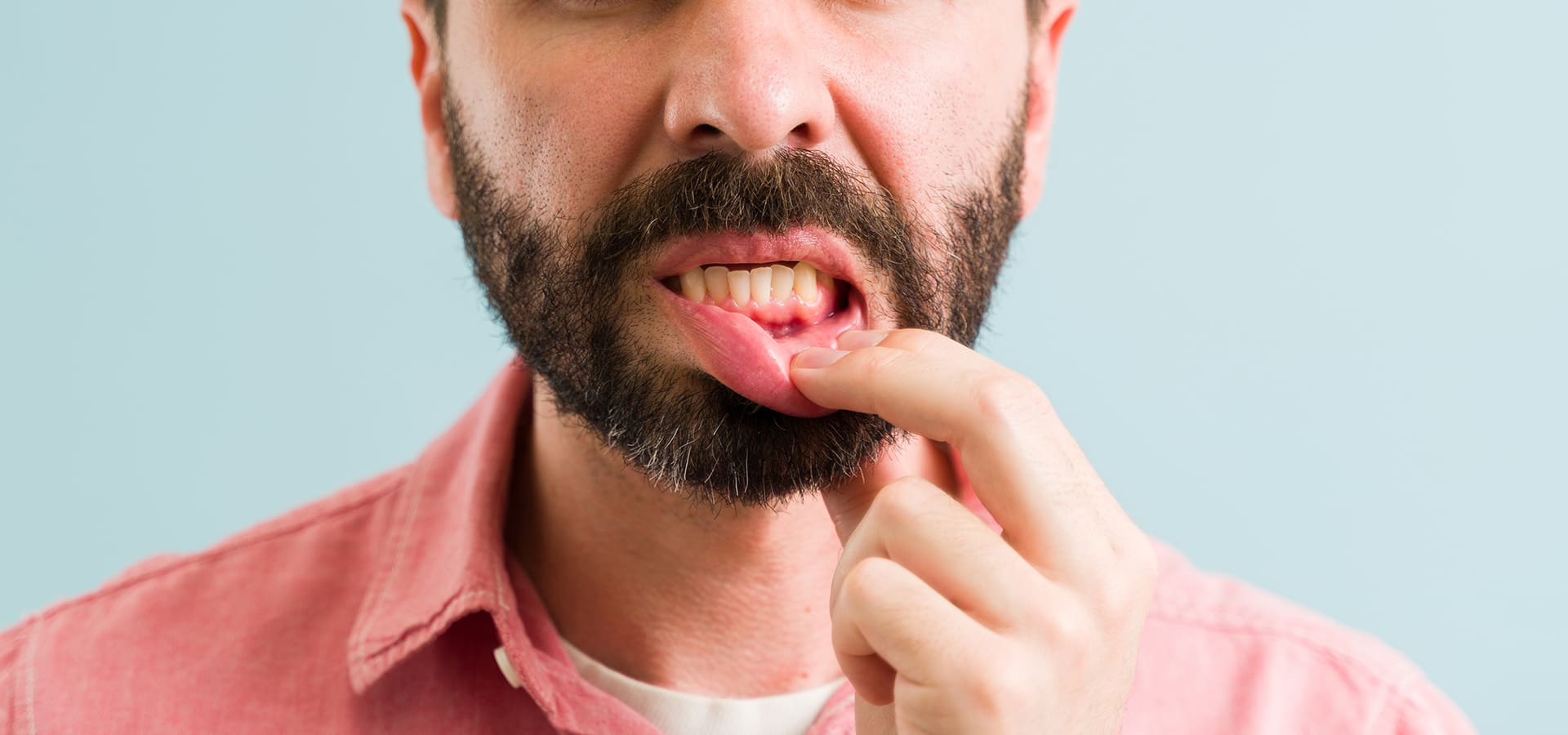 The Stages of Periodontal Disease and How They Progress